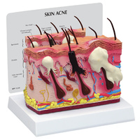 Skin Normal/Acne