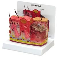 Anatomical Model - SKIN, NORMAL /BURN