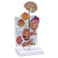 Anatomical Model- Hypertension Model Set