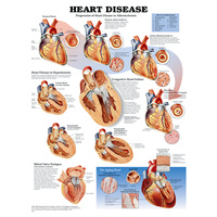 Anatomical Heart Disease Chart