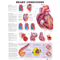 Heart Conditions (Poster - Rigid Lamination)