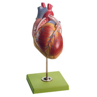 HEART WITH BYPASS VESSELS