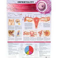 Infertility (Poster - Soft Lamination)