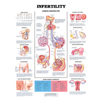 Infertility Chart
