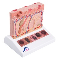Anatomical Models of Skin Cancer
