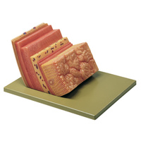 Stomach Wall