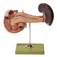 Pancreas with Spleen and Duodenum