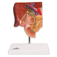 Anatomical Model- Gallstone Model