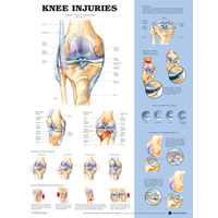 Knee Injuries (Poster - Soft Lamination)