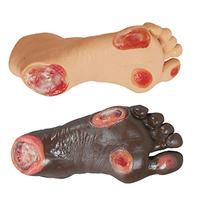 Elderly Pressure Ulcer Foot