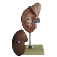 Right Kidney and Adrenal Gland