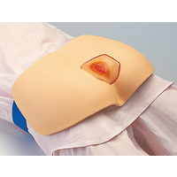 Sakamoto Decubitis Ulcer Management Simulator