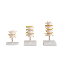 Anatomical Lumbar Set Model(4 pcs)