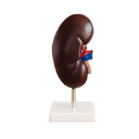 Anatomical Kidney Model (2 parts)