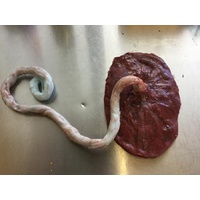 Placenta And Umbilical Cord