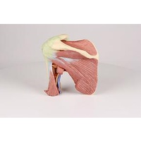 Anatomical Model- Shoulder deep dissection of the left shoulder joint, musculature, and associated nerves and vessels