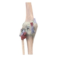 Anatomical Model- Knee Joint extended