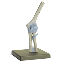 Elbow Joint