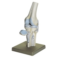 Knee Joint