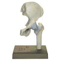 Hip Joint