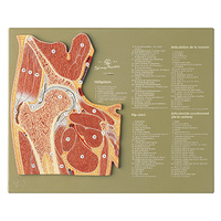 Section through the Hip Joint