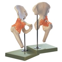 Functional Hip Joint