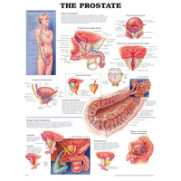 Anatomical Chart- The Prostate