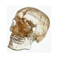 Somso Artificial Transparent Human Skull