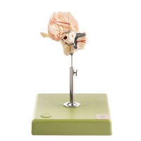 Artificial Temporal Bone