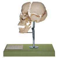 Artificial Bauchene Skull of an Adult