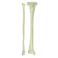 Somso Tibia & Fibula Bone