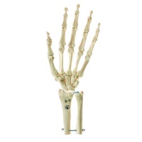 Somso Skeleton of the Hand with Base of Forearm