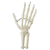 Skeleton of the Hand with Part Forearm