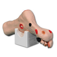 Wilma Wound Foot