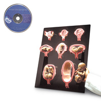 Gaumard Intrauterine Human Development Models and Fetal Ultrasounds CD-ROM