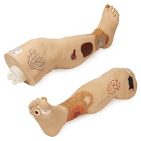 Vinnie Venous Insufficiency Leg 