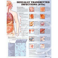 Anatomical Chart- Sexually Transmitted Infections