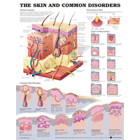 The Skin and Common Disorders (Poster - Rigid Lamination)