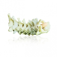 PHACON Cervical Spine Patient “Schubert” – Flexible