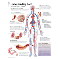 Understanding PAD