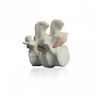 PHACON Lumbar Spine Patient “Bach” – Small