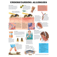 Anatomical Chart- Understanding Allergies 