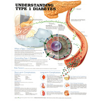 Anatomical Chart- Understanding Type 2 Diabetes