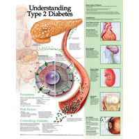 Anatomical Chart- Understanding Type 2 Diabetes