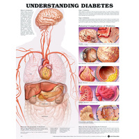 Anatomical Chart- Understanding Diabetes 