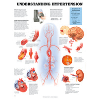 Anatomical Chart- Understanding Hypertension 