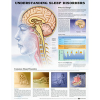 Understanding Sleep Disorders Chart