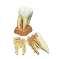 Anatomical Upper Triple Root Molar (2pt) Model