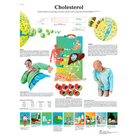 Anatomical Models and Charts for Cholesterol 