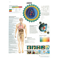 Anatomical Models of AIDS Chart